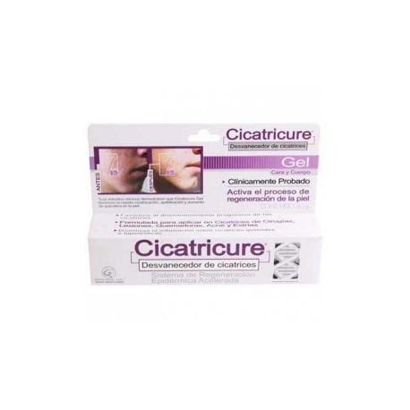 CICATRICURE GEL 60G DESVANECED - Envío Gratuito